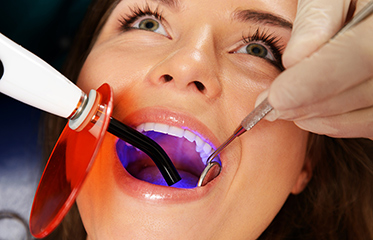 The Importance of Treating Dental Cavities on Time