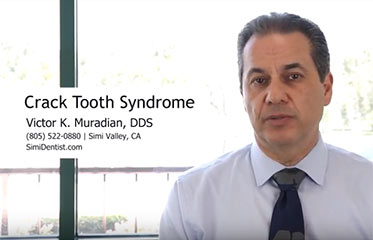 Cracked Tooth Syndrome Simi Valley
