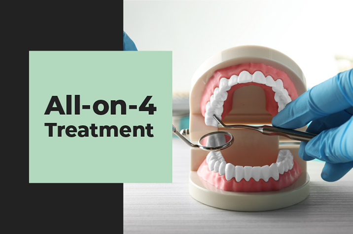 All-on-4 Treatment