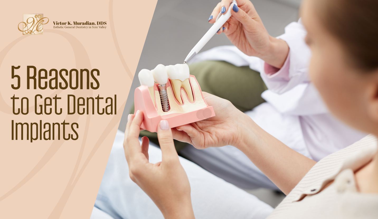 5 Reasons to Get Dental Implants