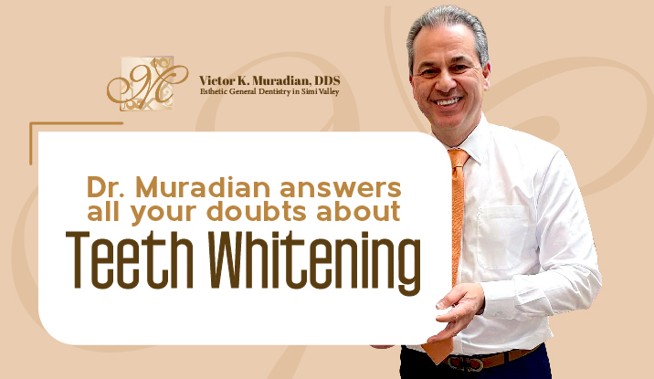 Teeth Whitening Most Common Asked Questions