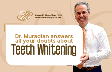 Teeth Whitening Most Common Asked Questions