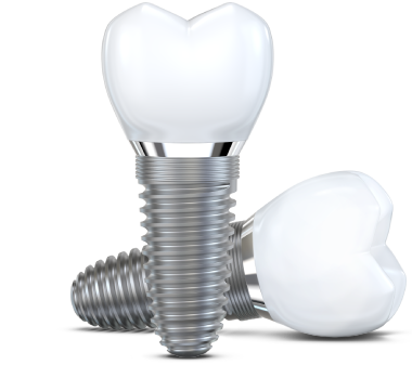 Dental Implants